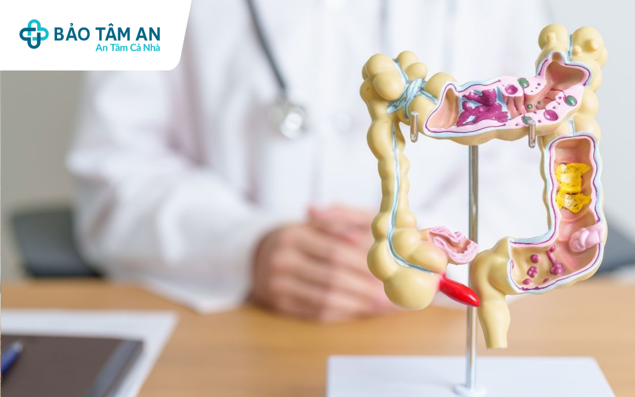 nhung-thuc-pham-tot-cho-he-tieu-hoa-nha-thuoc-bao-tam-an