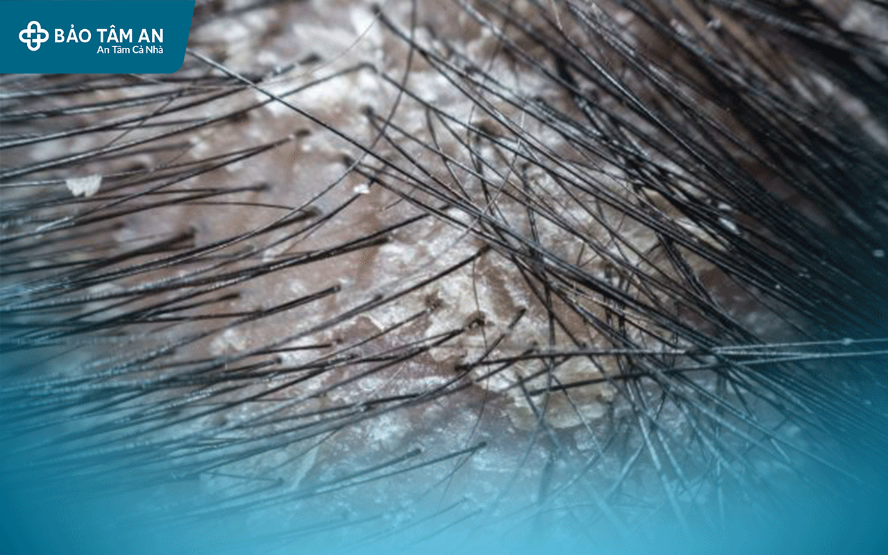 nam-da-dau-lam-sao-khac-phuc-nha-thuoc-bao-tam-an