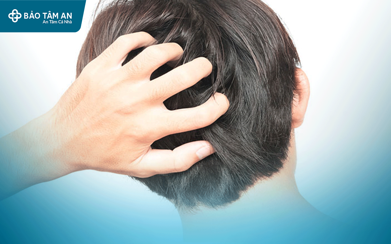 nam-da-dau-lam-sao-khac-phuc-nha-thuoc-bao-tam-an